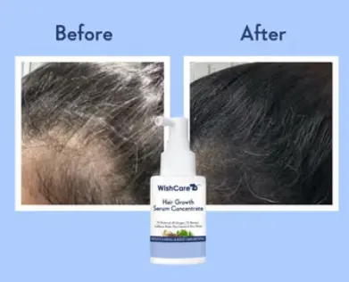Wishcare Hair Growth Serum